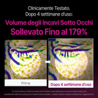 Crema coreana calcio dark per contorni occhi